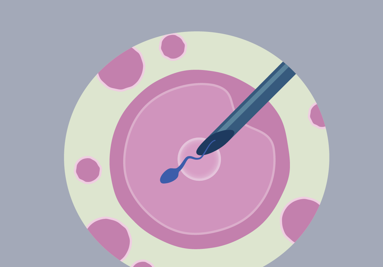 Medication For Embryo Transfer Progyny