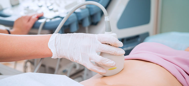 woman getting a sonogram