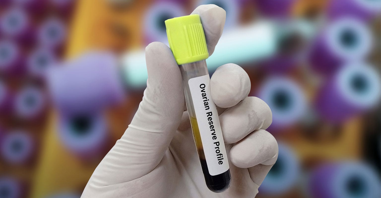 tube marked ovarian reserve profile with a blood sample