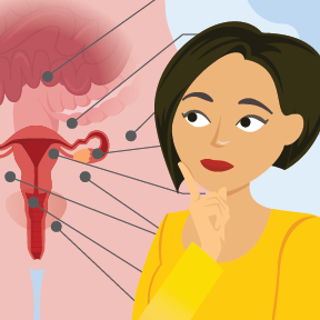 Endometriosis_Featured_Thumbnail