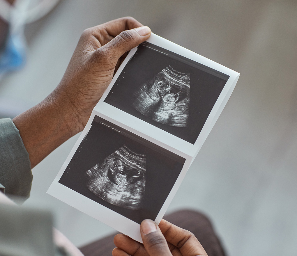 hands holding sonogram photos